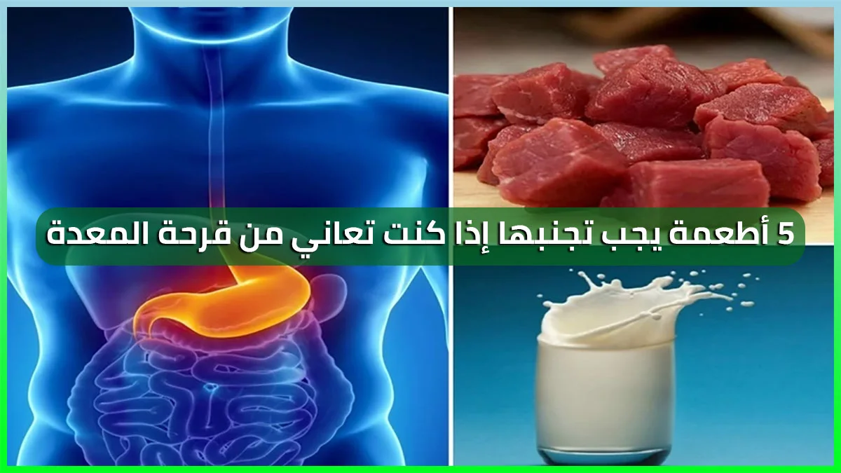 5 أطعمة يجب تجنبها إذا كنت تعاني من قرحة المعدة