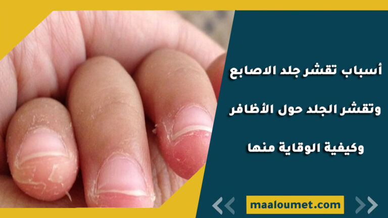 أسباب تقشر جلد الاصابع وتقشر الجلد حول الأظافر وكيف يمكن الوقاية منها