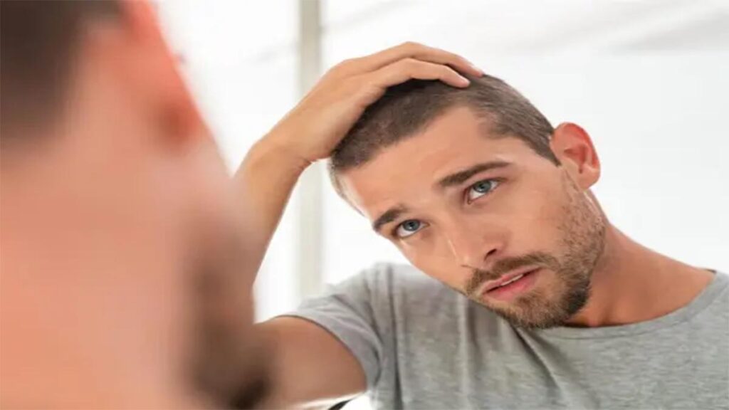 علاج تساقط الشعر للرجال